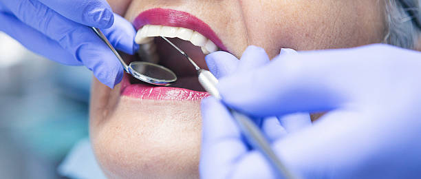 Best Root Canal Emergency Dentist  in East Village, CT